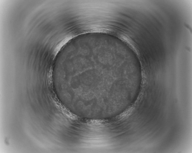 X0000099380875200805291126