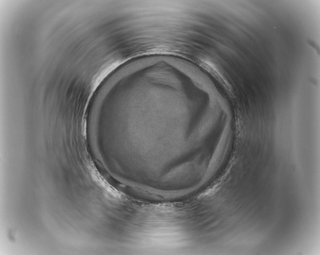 X0000099380900200805291126