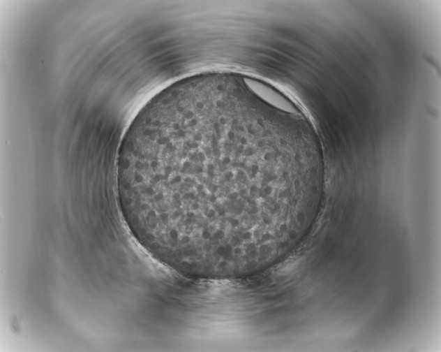 X0000099380903200805291126