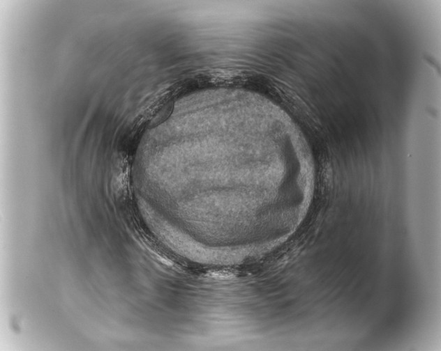 X0000099380914200805291125