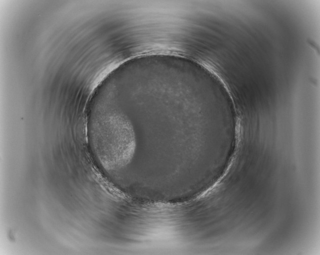 X0000099380925200805291125