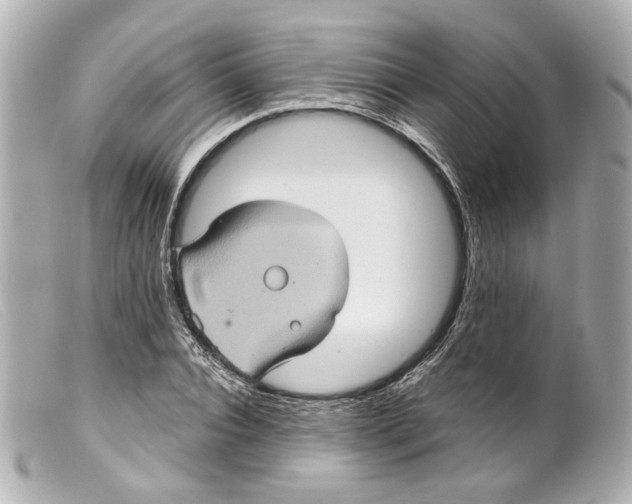 X0000099380928200805291125