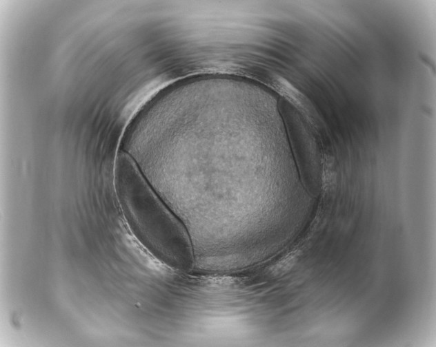 X0000099380940200805291125