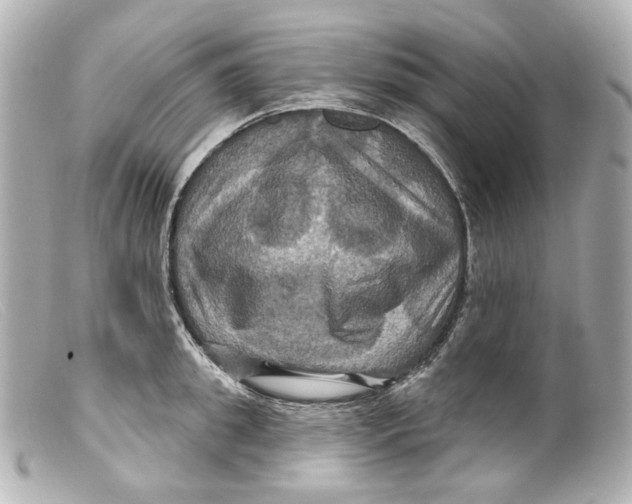 X0000099380949200805291125