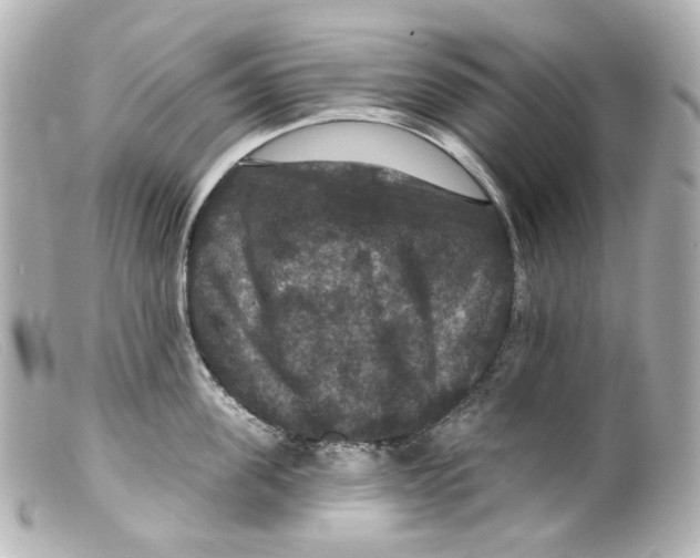 X0000099380955200805291126