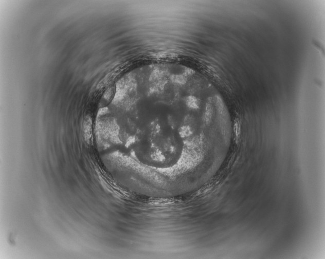 X0000099380963200805291125