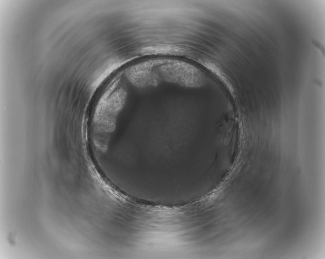 X0000099380983200805291125