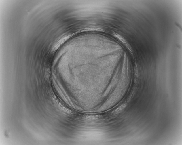 X0000099380985200805291125