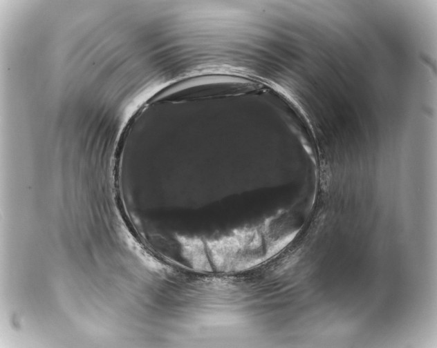 X0000099380995200805291125