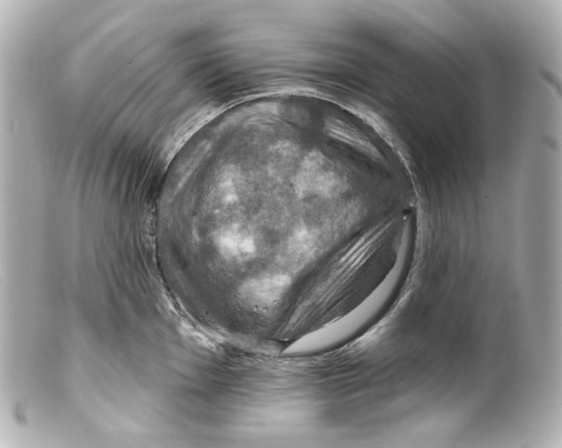 X0000099381001200805291124