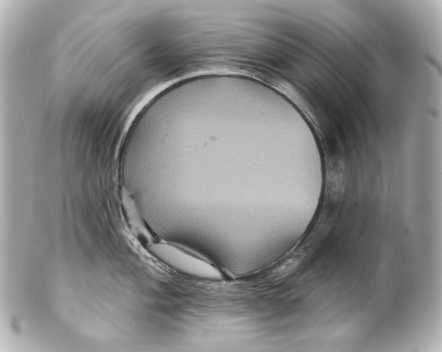 X0000099381004200805291124