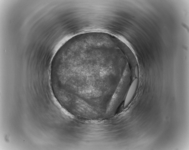 X0000099381005200805291124