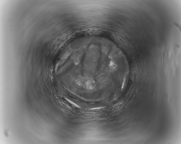 X0000099381010200805291124