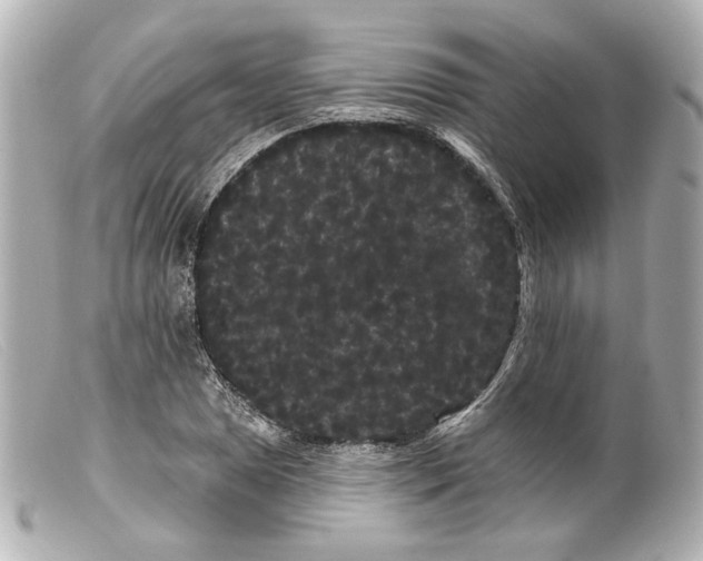 X0000099381025200805291124