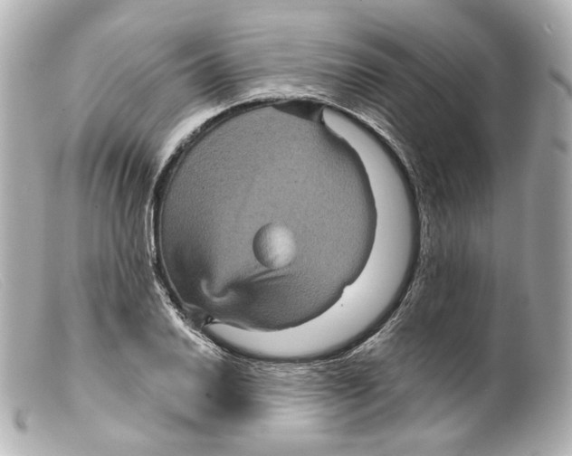 X0000099381030200805291124