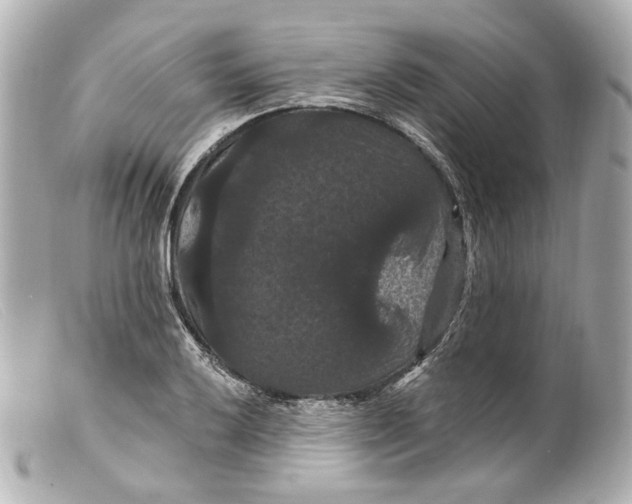 X0000099381032200805291124