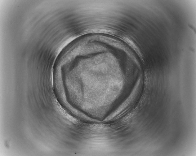 X0000099381036200805291124