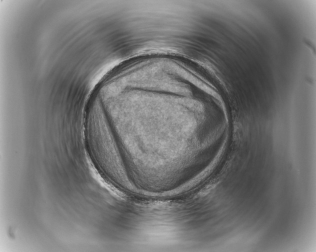 X0000099381038200805291124