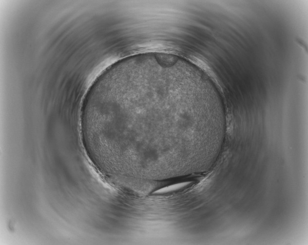 X0000099381043200805291124