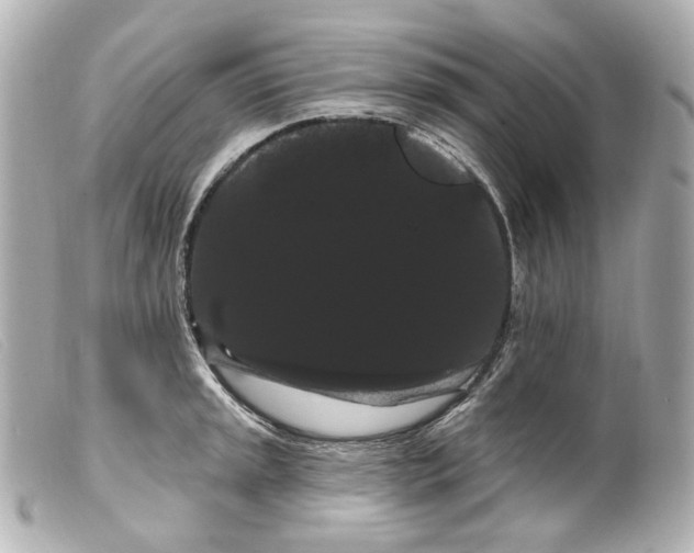 X0000099381045200805291124