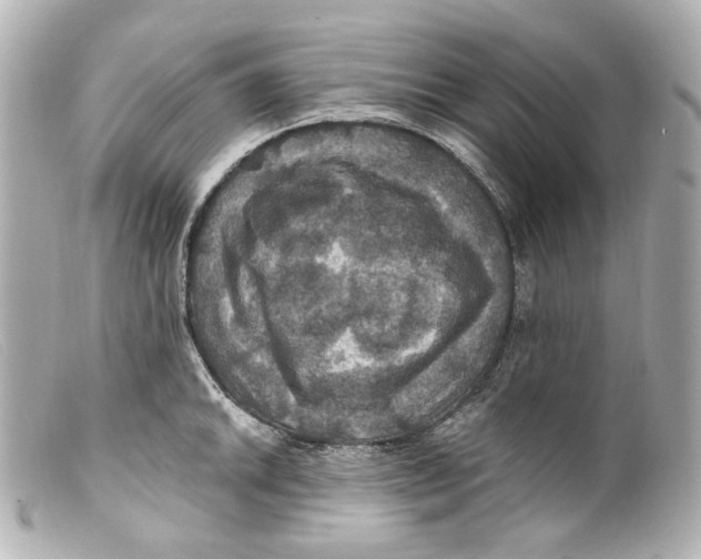 X0000099381046200805291124