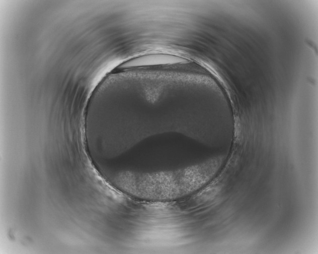 X0000099381048200805291124