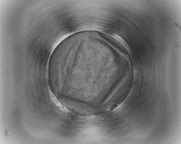 X0000099381052200805291124