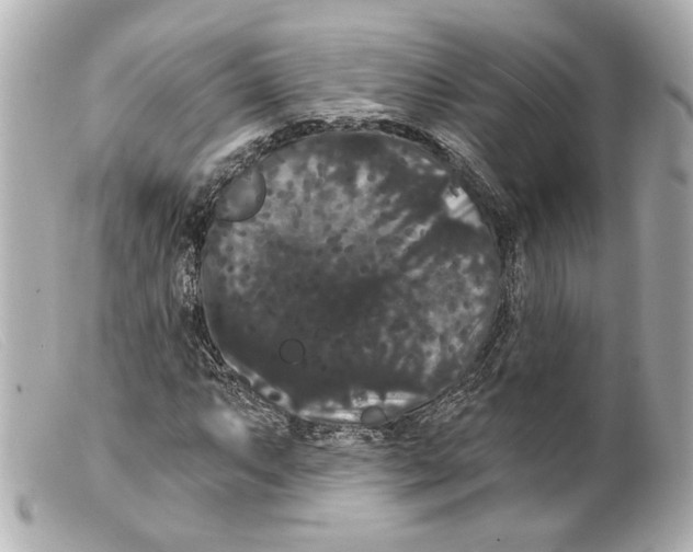 X0000099381063200805291124