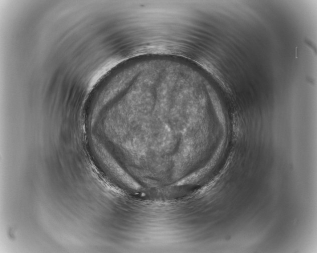 X0000099381070200805291123