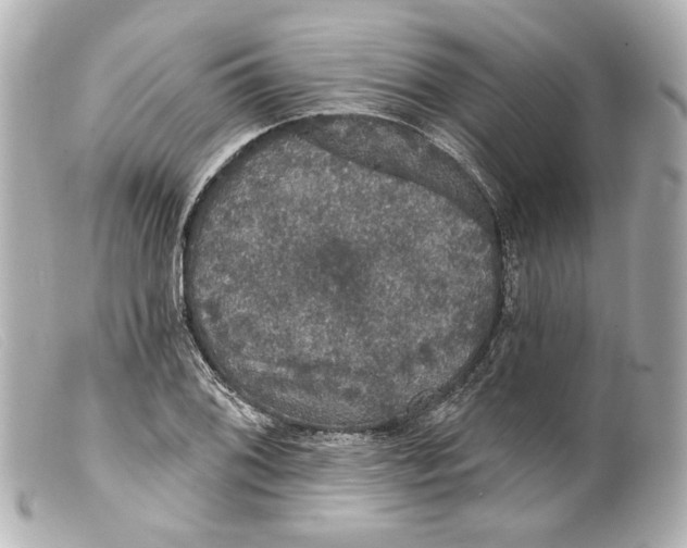 X0000099381076200805291123