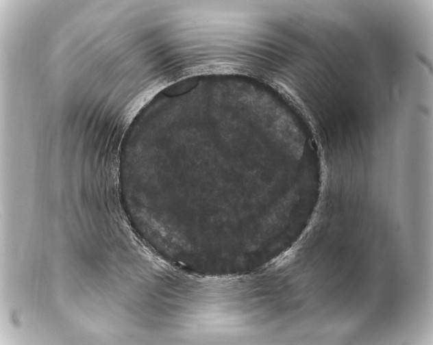 X0000099381081200805291123