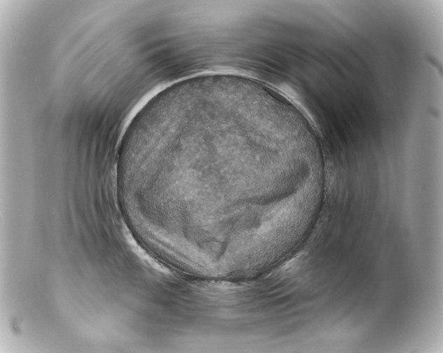 X0000099381100200805291123