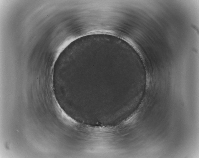 X0000099381102200805291123