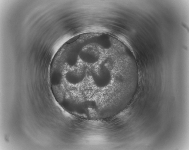 X0000099381103200805291123