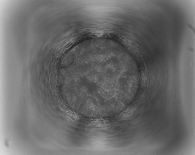 X0000099381105200805291122