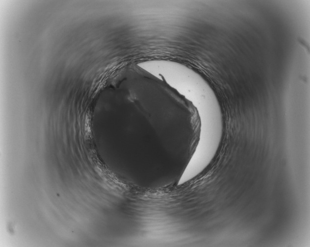 X0000099381106200805291122