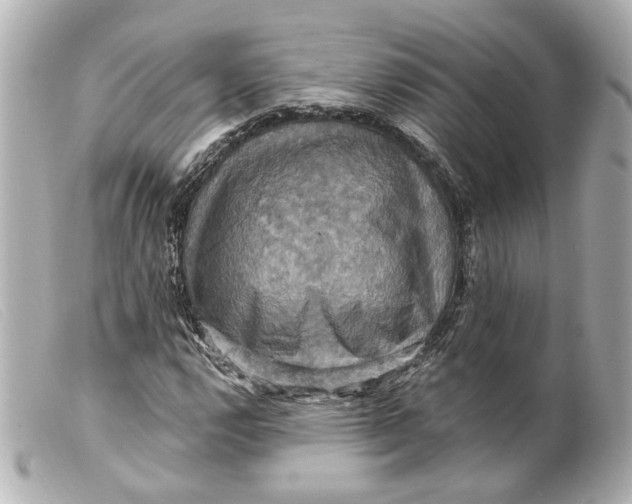 X0000099381112200805291122