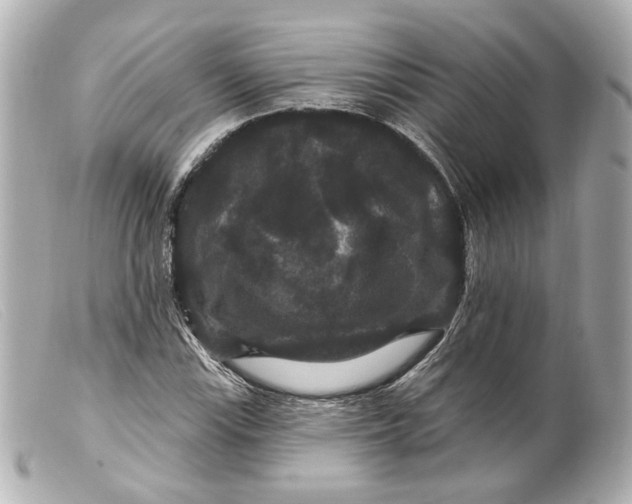 X0000099381115200805291123