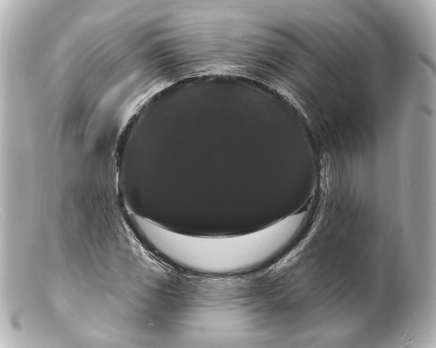 X0000099381117200805291123