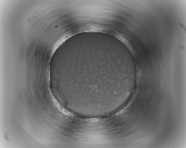 X0000099381130200805291123