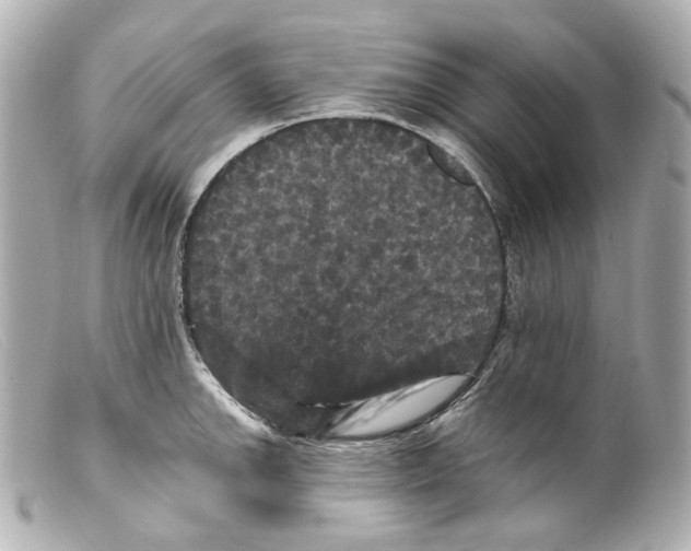 X0000099381142200805291123