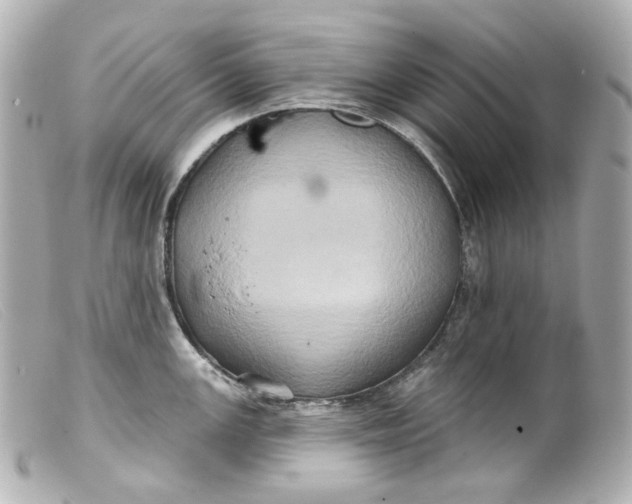 X0000099381147200805291123