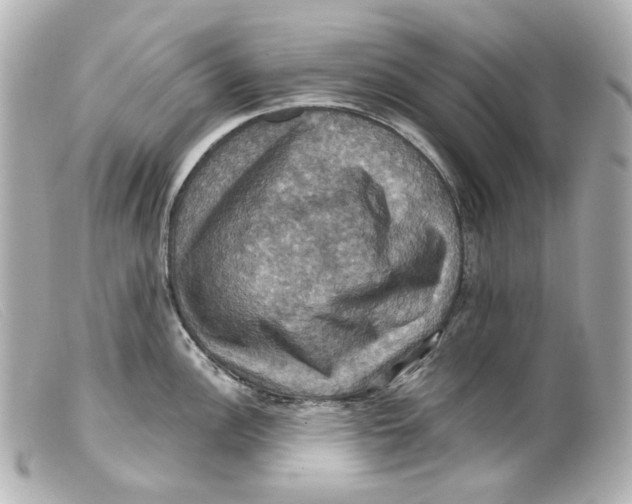 X0000099381148200805291123