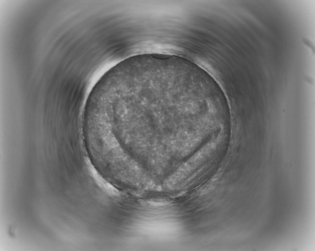 X0000099381152200805291123