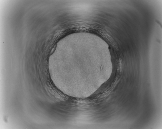 X0000099381153200805291122