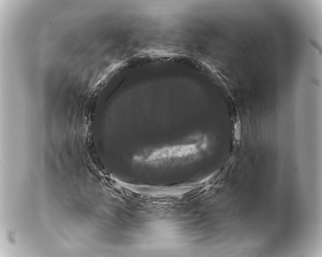 X0000099381157200805291122