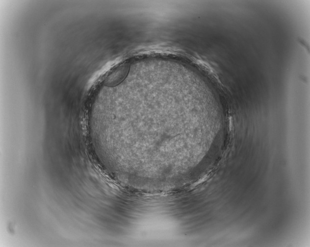 X0000099381159200805291122