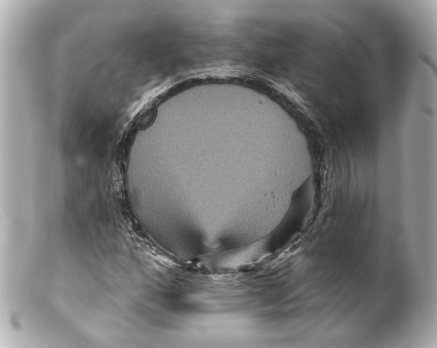 X0000099381160200805291122