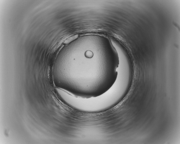 X0000099381161200805291122