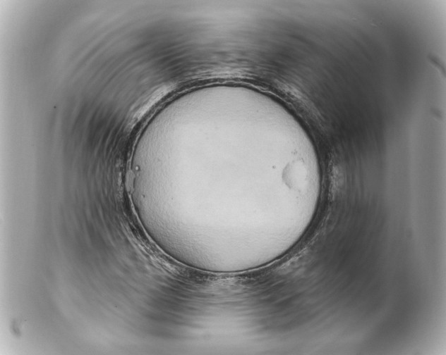 X0000099381162200805291122